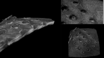 3D detection Pantec Biosolutions black grey development process tissue image processing micropores dermatology